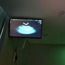 현대가정의원 | [다낭성 20대 시험관] 청주 엠에스여성의원 시험관 1차/동결 이식전 내막 점검