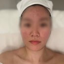 나로부터 | 위례 피부관리 나로부터 아름다운 프롬미 위례점 만족후기