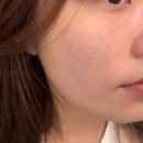 씨유 야음신선로점 | 울산 피부관리 추천｜모공 관리 제대로 받은 올가드림뷰티 야음점