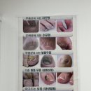 [내돈내산] 일산역 문제성발 관리 &#39;그리심 네일&amp;뷰티&#39;