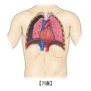 공기 가슴증(기흉) (Pneumothorax) 호흡기질환 이란? 이미지