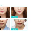 더예쁜성형외과의원 이미지