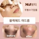 MJ뷰티(네일)