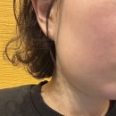 인터넷유니버스 | [대구 중구 피부과]슈링크 유니버스 600샷 인모드FX 내돈 내산 솔직후기