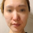 메디제이 | 30대 홍조 피부 진정크림 추천｜메디제이 더블유크림 붉은기 리얼 사용후기