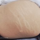 천안탈모튼살스킨커버아카데미 이미지