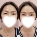 히미B | 김해 진영여자눈썹 잘하는곳 히미비 내돈내산 찐 후기