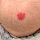 오즈피부과의원 이미지