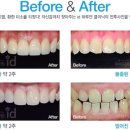 아이디치과기공소 이미지