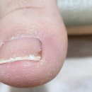 언주로7길 | [서초내성발톱] 파고드는 발톱 때문에 힘들다면? 서초 문제성 발 전문 샵 방문 후기!