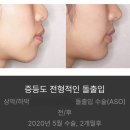 2010성형외과의원 | 압구정오렌지성형외과 돌출입수술,턱끝수술 ,김영조 박사?는