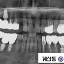 더디자인치과기공소 이미지