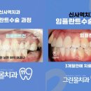 강남사랑니치과의원 이미지