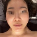 페이스라인 - 청주시 서원구 예체로 81 | 끌리메 대전 관저점 | 대전 에스테틱 골드페이스라인 후기 5월 더블 할인 이벤트