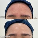 렛미인 스킨케어