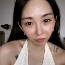 그룹 AOA 출신 권민아, 2도화상 의료사고 회복 근황…어딘지 달라진 분위기 이미지