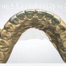 월드베스트디지털치과기공소 이미지