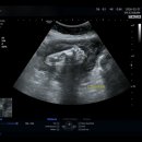 서초중앙로20길 29 (1) | [임신기록♡ 29~32주]