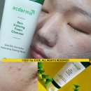 김영희스킨케어 | 여드름 폼클렌징 아크더마 스킨카밍 피지케어