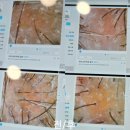 탈모케어존