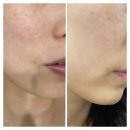 철강로25번길 40 | [포항 피부관리] 프레아 에스테틱에서 맞춤관리로 작은얼굴 관리 받은 후기