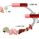 패혈증~~~ 이미지