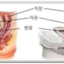 수축 이미지