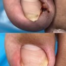 구로-구로-구로-163 이미지