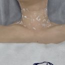 여수 죽림 피부관리 추천, 샤인미가 내돈내산 솔직후기/쥐젖 편평사마귀 제거