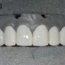 모치과기공소 이미지