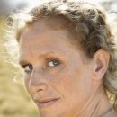 임마누엘스킨