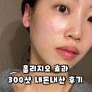 바른턱얼굴미치과의원 | 올리지오 후기 효과 300샷 이수역 피부과 내돈내산