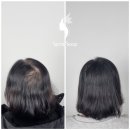 우림카이저팰리스아파트경로당 | 자연스러운 탈모 커버 가능한 송도 두피문신 SMP란 무엇일까?