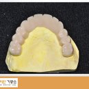 다이안치과기공소 이미지