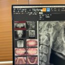 연세바로치과교정과치과의원 | 30대 성인교정 구리 연세바로치과교정치과 내돈내교