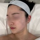 채움핏 | 수원피부관리 더라르떼 수원인계점 스킨가든핏 관리 대만족 후기