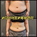 동삭동 소로 3-406 | 동삭동헬스장 평택여자pt 다이어트 체형교정 정주트레이너와 함께라면 만족도2000%