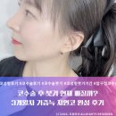 영광동물병원 | 코수술 후 붓기 언제 빠질까? 3개월차 기증늑 자연코 완성 후기