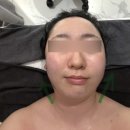 작은지구 | 광주 상무지구에스테틱 끌리메 작은얼굴 윤곽관리 후기