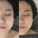 리턴스킨 | 산본 리턴스킨 예비신부 얼굴관리후기