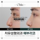 치유성형외과의원 이미지