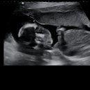 지에스25 신림양지점 | 🤰임신 19주 3일, 아꿍이랑 함께한 내돈내산 병원 데이트💸+ 신림춘천집 점심 후기까지!📍