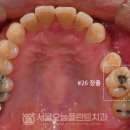 서원동-36 네이버블로그