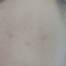 맑은약국 | <디에스 시카 멜라 리페어 크림> | 약국재생크림추천 점뺀후재생크림 솔직후기