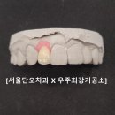 최강치과기공소 네이버블로그