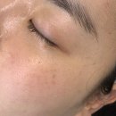 강동-천호-2438 | [강동] 천호 강동역 피부관리샵 미작뷰티 강동점 기미잡티제거 클리어스팟 미백효과