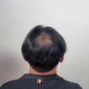 도트락 수원직영점 | 수원두피케어 잘해주시는 도트락 수원직영점에서 두피케어 받고 있어요.