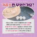 보령치과기공소 이미지