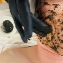 두꺼비로60번길(3-250) | 피부각질관리 산남동피부관리 스킨스토리 바이오필링 솔직후기