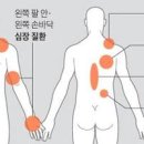 등 통증 목디스크 대상포진 췌장염 점액낭염 근막통증증후군 통증 이미지